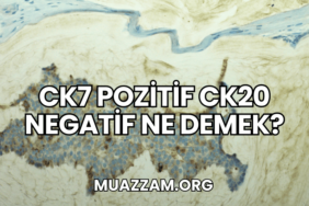 CK7 Pozitif CK20 Negatif Ne Demek?