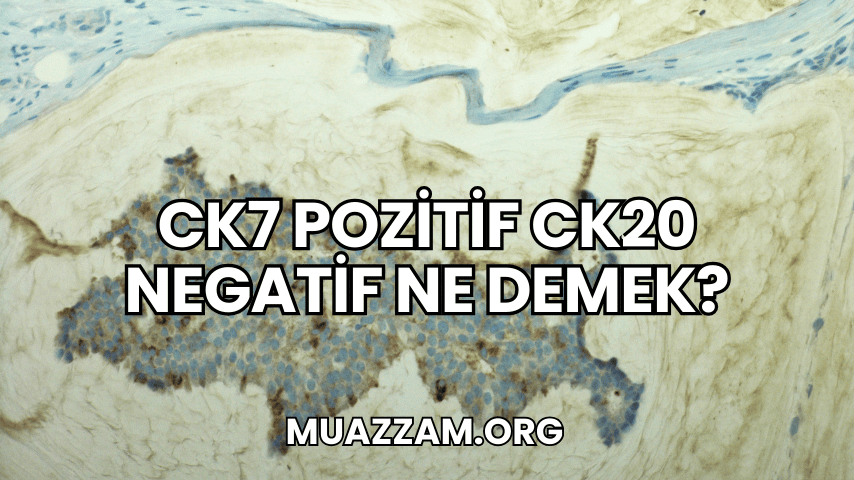 CK7 Pozitif CK20 Negatif Ne Demek?